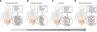 The implication of gut microbiota in recovery from gastrointestinal surgery